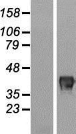 Novus Biologicals&trade;&nbsp;FAM83A Overexpression Lysate