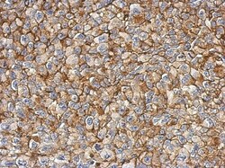 FAM83B Antibody, Novus Biologicals 0.1mL; Unlabeled:Antibodies, Polyclonal