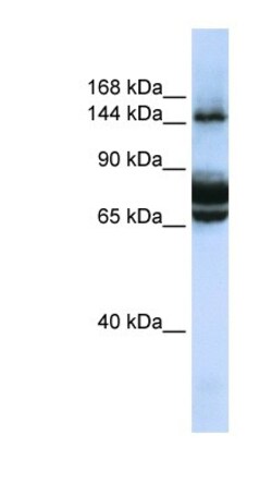 FAM83B Antibody, Novus Biologicals 100&mu;L; Unlabeled:Antibodies, Polyclonal