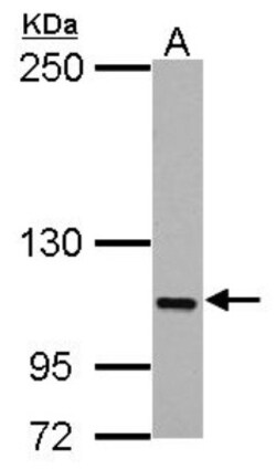 FAM83B Antibody, Novus Biologicals 0.1mL; Unlabeled:Antibodies, Polyclonal