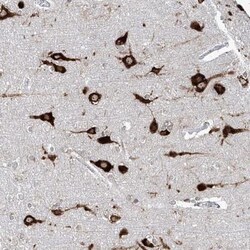 C12orf4 Antibody, Novus Biologicals:Antibodies:Primary Antibodies