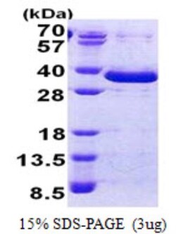Novus Biologicals&trade;&nbsp;Recombinant Human FAM84A His Protein