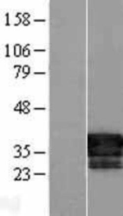 Novus Biologicals™ FAM84B Overexpression Lysate