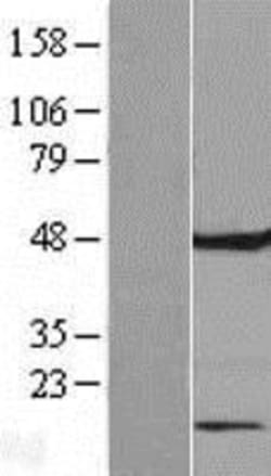 Novus Biologicals&trade;&nbsp;FAM86C Overexpression Lysate