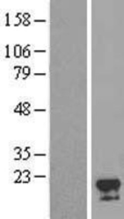 Novus Biologicals&trade;&nbsp;FAM96A Overexpression Lysate