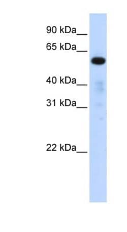 FAM98A Antibody, Novus Biologicals 100 &mu;L | Buy Online | Novus Biologicals | Fisher Scientific