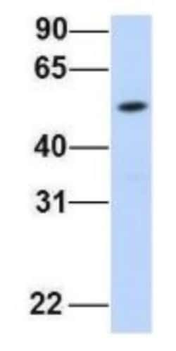 FAM98A Antibody, Novus Biologicals 100 &mu;L | Buy Online | Novus Biologicals | Fisher Scientific