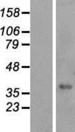 Novus Biologicals&trade;&nbsp;FAM98C Overexpression Lysate