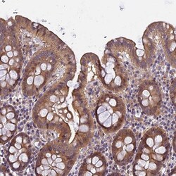 FAM98C Antibody, Novus Biologicals 25 &mu;L, Unlabeled:Antibodies, Polyclonal