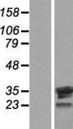 Novus Biologicals™ FAM9B Overexpression Lysate