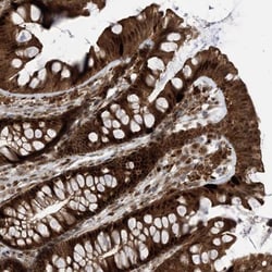 FAM9B Antibody, Novus Biologicals:Antibodies:Primary Antibodies