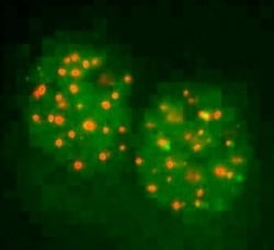 FANCD2 Antibody - BSA Free, Novus Biologicals:Antibodies:Primary Antibodies