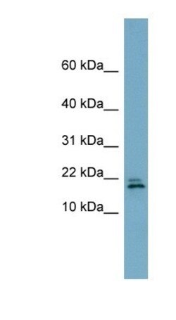 FANCD2OS Antibody, Novus Biologicals 100&mu;L; Unlabeled:Antibodies, Polyclonal