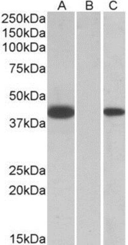 FANCF Antibody, Novus Biologicals 0.1mg; Unlabeled:Antibodies, Polyclonal