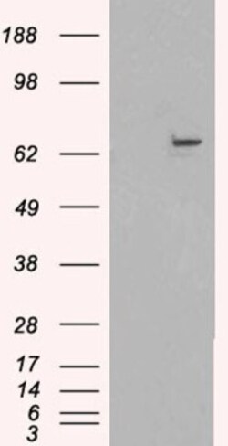 FANCG Antibody, Novus Biologicals 0.1mg; Unlabeled:Antibodies, Polyclonal