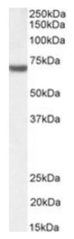 FANCG Antibody, Novus Biologicals 0.1mg; Unlabeled:Antibodies, Polyclonal