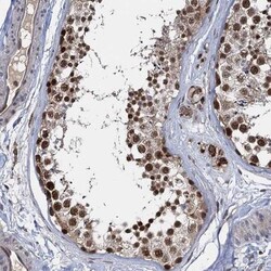 FANCI Antibody, Novus Biologicals 0.1mL; Unlabeled:Antikroppar