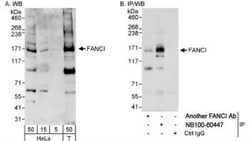 anti-FANCI, Polyclonal, Novus Biologicals 0.1mL; Unlabeled, Quantity: 0.1