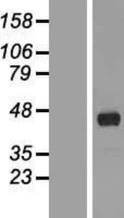 Novus Biologicals™ FANK1 Overexpression Lysate