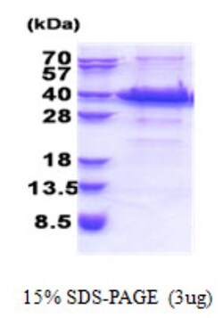Novus Biologicals&trade;&nbsp;Recombinant Human FANK1 His Protein