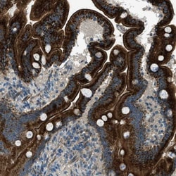 FAR1 Antibody, Novus Biologicals 0.1mL; Unlabeled:Antibodies, Polyclonal