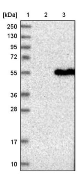 FARS2 Antibody, Novus Biologicals 0.1 mL | Buy Online | Novus Biologicals | Fisher Scientific