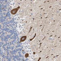 FARS2 Antibody, Novus Biologicals 0.1 mL | Buy Online | Novus Biologicals | Fisher Scientific