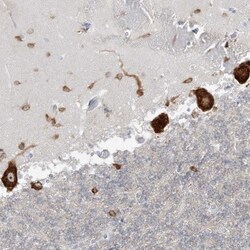 FARSB Antibody, Novus Biologicals 0.1mL; Unlabeled:Antibodies, Polyclonal