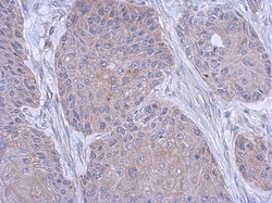 FARSB Antibody, Novus Biologicals 0.1mL; Unlabeled:Antibodies, Polyclonal