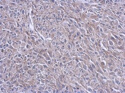 FARSB Antibody, Novus Biologicals 0.1mL; Unlabeled:Antibodies, Polyclonal
