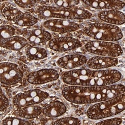 FARSLA Antibody, Novus Biologicals 0.1mL; Unlabeled:Antibodies, Polyclonal