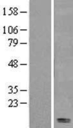 Novus Biologicals&trade;&nbsp;Fas/TNFRSF6/CD95 Overexpression Lysate