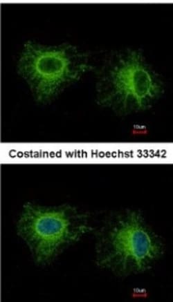 Fast skeletal myosin light chain 1 Antibody, Novus Biologicals 0.1mL; Unlabeled:Antibodies,