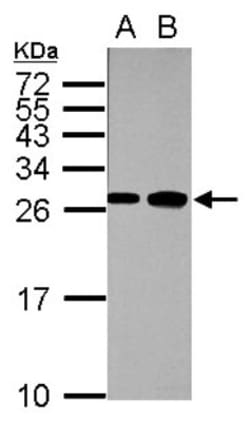 Fast skeletal myosin light chain 1 Antibody, Novus Biologicals 0.1mL; Unlabeled:Antibodies,
