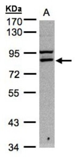 FASTKD1 Antibody, Novus Biologicals 0.1mL; Unlabeled:Antibodies, Polyclonal