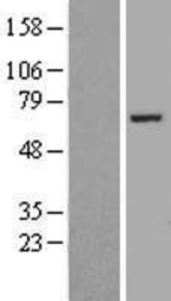 Novus Biologicals&trade;&nbsp;FASTKD2 Overexpression Lysate