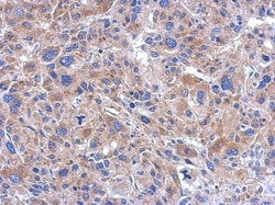 FASTKD5 Antibody, Novus Biologicals 0.1mL; Unlabeled:Antibodies, Polyclonal