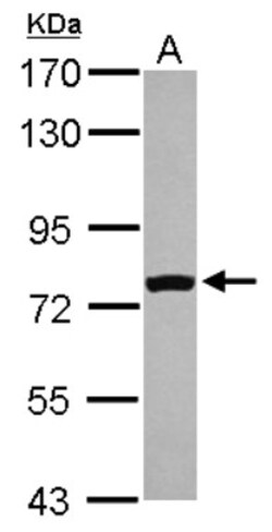 FASTKD5 Antibody, Novus Biologicals 0.1mL; Unlabeled:Antibodies, Polyclonal
