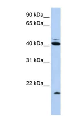 FAT10 Antibody, Novus Biologicals 100&mu;L; Unlabeled:Antibodies, Polyclonal