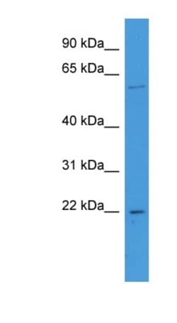 FATE1 Antibody, Novus Biologicals 100&mu;L; Unlabeled:Antibodies, Polyclonal
