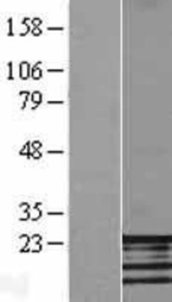 Novus Biologicals™ FATE1 Overexpression Lysate