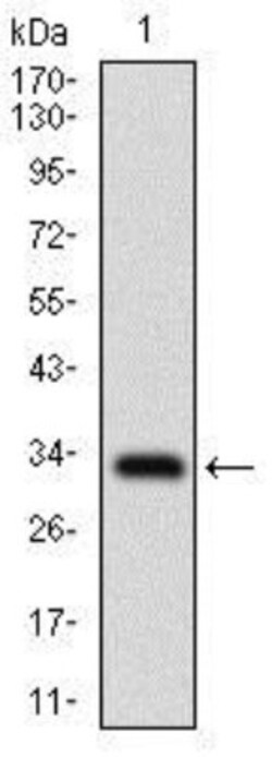 FATP2/SLC27A2 Antibody (6B3A9) - BSA Free, Novus Biologicals 0.1mL; Unlabeled:Antibodies,