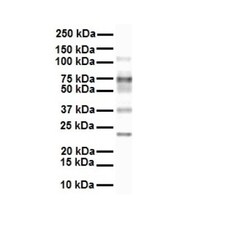 FATP3/SLC27A3 Antibody, Novus Biologicals:Antibodies:Primary Antibodies