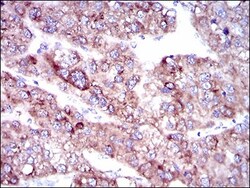 FATP5/SLC27A5 Antibody (9C4D1) - BSA Free, Novus Biologicals:Antibodies:Primary