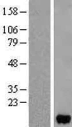 Novus Biologicals&trade;&nbsp;FABP5/E-FABP Overexpression Lysate