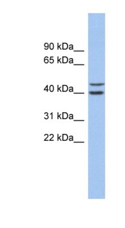 Fbl14 Antibody, Novus Biologicals:Antibodies:Primary Antibodies