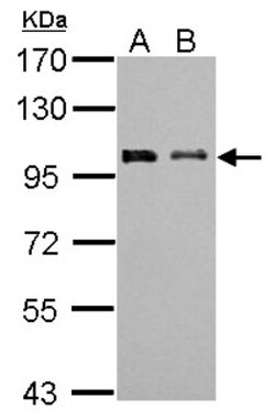 anti-F-box protein 43, Polyclonal, Novus Biologicals 0.1mg; Unlabeled:Antibodies,