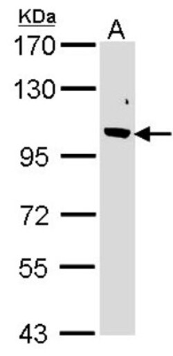 anti-F-box protein 43, Polyclonal, Novus Biologicals 0.1mg; Unlabeled:Antibodies,