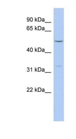 F-box protein 15/FBXO15 Antibody, Novus Biologicals 100&mu;L; Unlabeled:Antibodies,