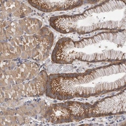 F-box protein 43 Antibody, Novus Biologicals 0.1mL; Unlabeled:Antibodies,